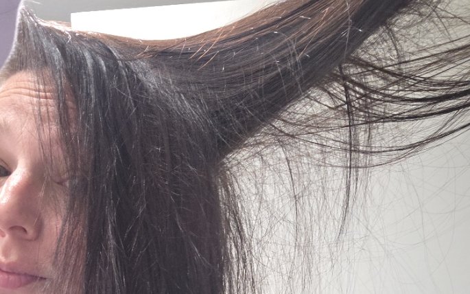 Backlit photo of my hairline, which looks fuller to me than it did a year ago